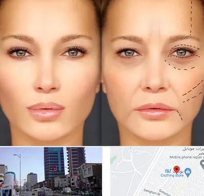 متخصص زیبایی چشم در چهارراه طالقانی کرج