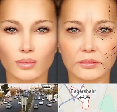 متخصص زیبایی چشم در باقرشهر