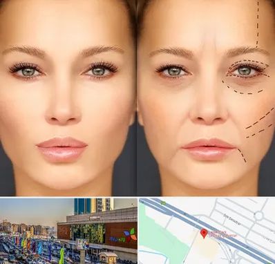 متخصص زیبایی چشم در لاله پارک تبریز