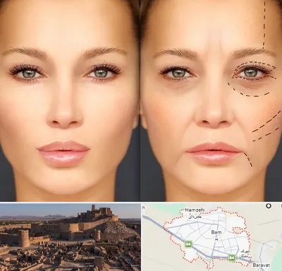 متخصص زیبایی چشم در بم