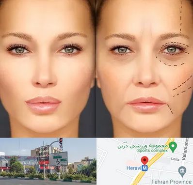 متخصص زیبایی چشم در هروی 