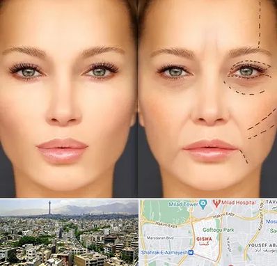 متخصص زیبایی چشم در گیشا 