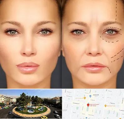 متخصص زیبایی چشم در هفت حوض 