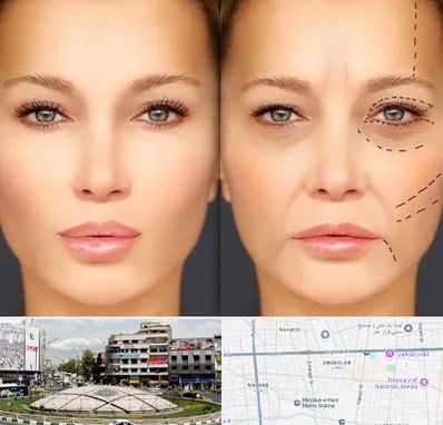 متخصص زیبایی چشم در مرکز تهران