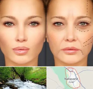 متخصص زیبایی چشم در نهاوند