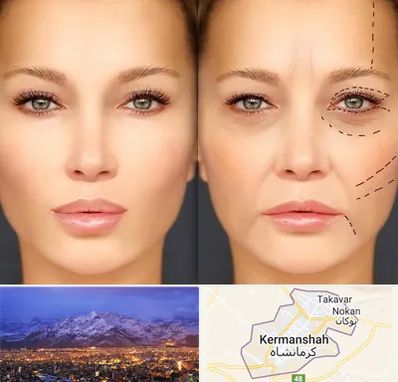 متخصص زیبایی چشم در کرمانشاه