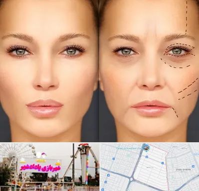 متخصص زیبایی چشم در پادادشهر اهواز
