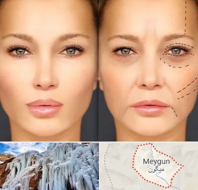متخصص زیبایی چشم در میگون