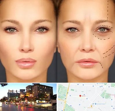 متخصص زیبایی چشم در بلوار سجاد مشهد 