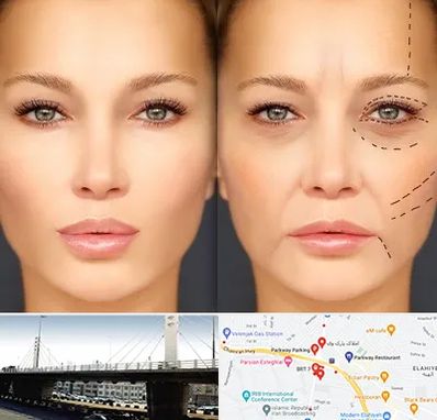 متخصص زیبایی چشم در پارک وی 