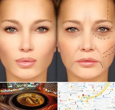 متخصص زیبایی چشم در میدان ولیعصر 