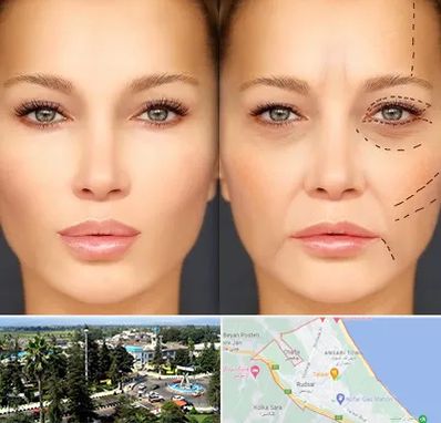 متخصص زیبایی چشم در رودسر