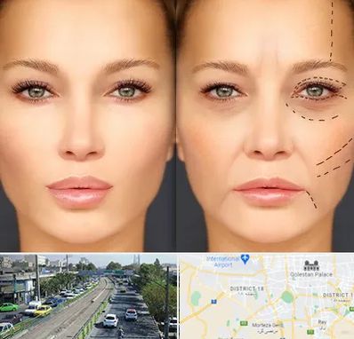 متخصص زیبایی چشم در جنوب تهران 