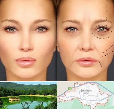 متخصص زیبایی چشم در بهشهر
