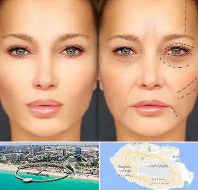متخصص زیبایی چشم در کیش