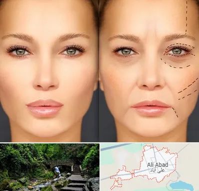 متخصص زیبایی چشم در علی آباد کتول