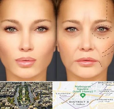 متخصص زیبایی چشم در نارمک 