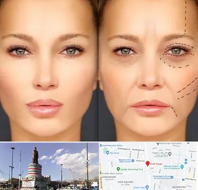 متخصص زیبایی چشم در کارگر جنوبی 