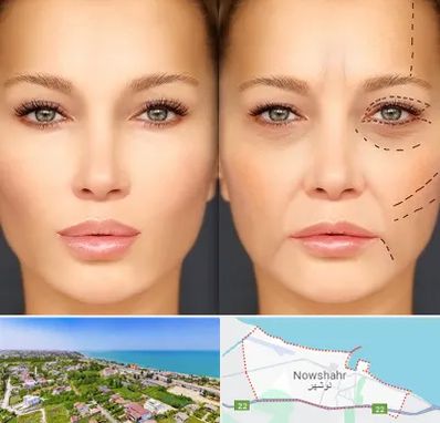 متخصص زیبایی چشم در نوشهر