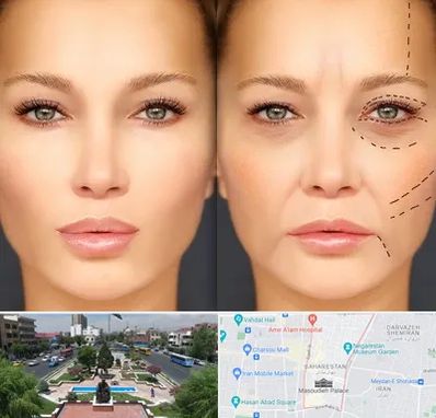 متخصص زیبایی چشم در بهارستان 