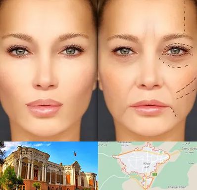 متخصص زیبایی چشم در خوی