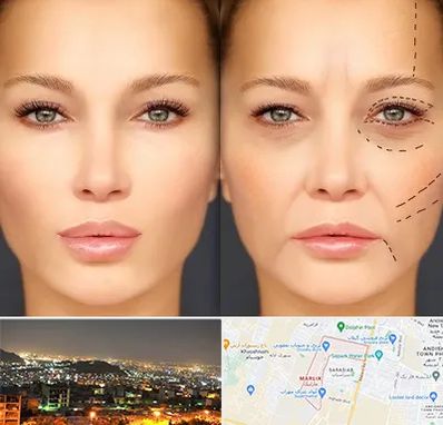 متخصص زیبایی چشم در مارلیک کرج