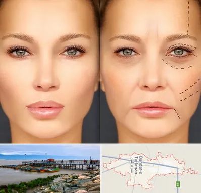 متخصص زیبایی چشم در بندر ترکمن