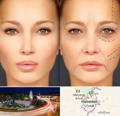 متخصص زیبایی چشم در همدان