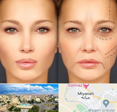 متخصص زیبایی چشم در میانه
