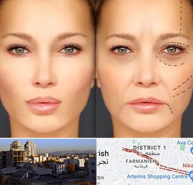 متخصص زیبایی چشم در فرمانیه 