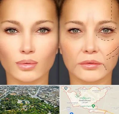 متخصص زیبایی چشم در شهرکرد