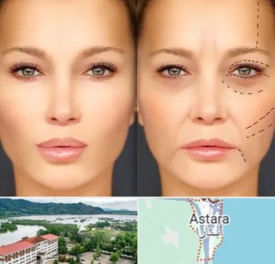 متخصص زیبایی چشم در آستارا