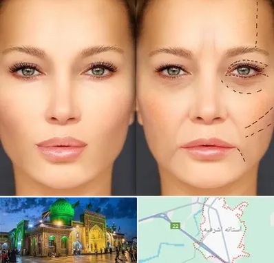 متخصص زیبایی چشم در آستانه اشرفیه