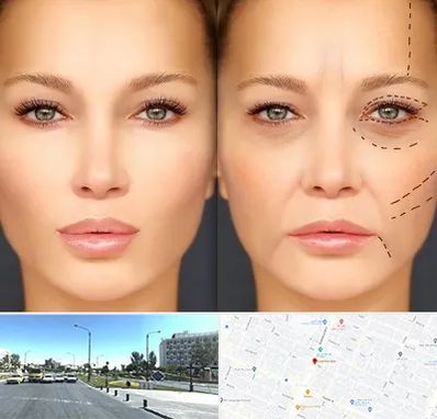 متخصص زیبایی چشم در بلوار کلاهدوز مشهد 