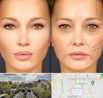 متخصص زیبایی چشم در یوسف آباد 