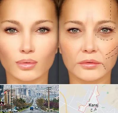 متخصص زیبایی چشم در گوهردشت کرج 