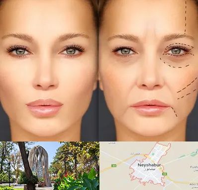 متخصص زیبایی چشم در نیشابور