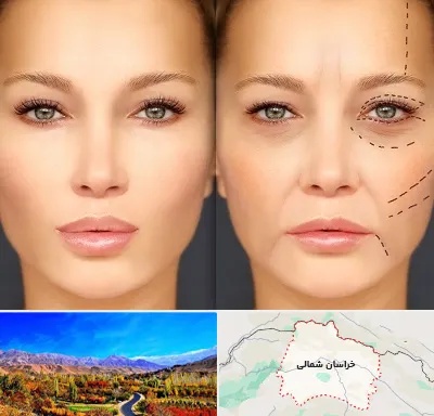متخصص زیبایی چشم در خراسان شمالی