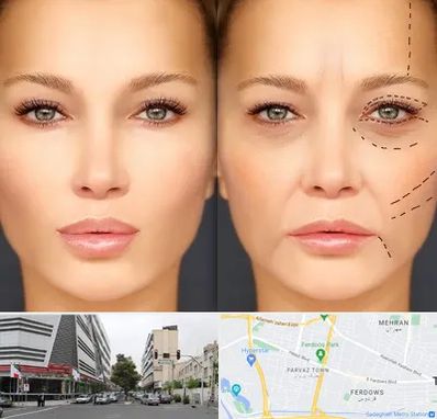 متخصص زیبایی چشم در بلوار فردوس 