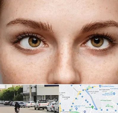 متخصص انحراف چشم در قدوسی شرقی شیراز