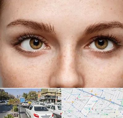 متخصص انحراف چشم در مفتح مشهد