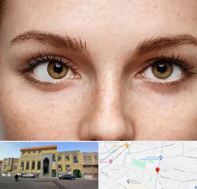 متخصص انحراف چشم در زنبیل آباد قم