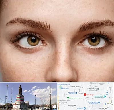 متخصص انحراف چشم در کارگر جنوبی 