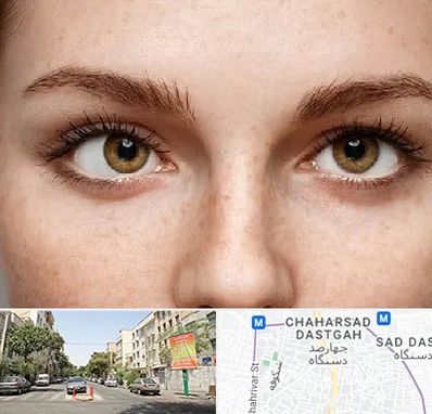 متخصص انحراف چشم در چهارصد دستگاه 