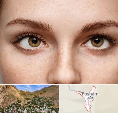 متخصص انحراف چشم در فشم