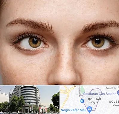 متخصص انحراف چشم در قلهک 