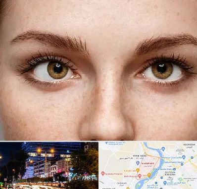 متخصص انحراف چشم در کیانپارس اهواز