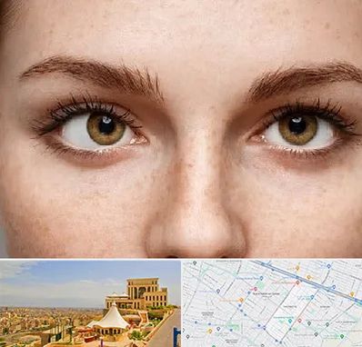 متخصص انحراف چشم در هاشمیه مشهد