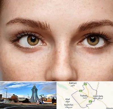 متخصص انحراف چشم در تایباد