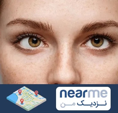 متخصص انحراف چشم در نزدیک من